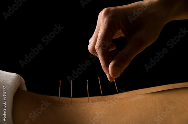 Obraz Acupuncture