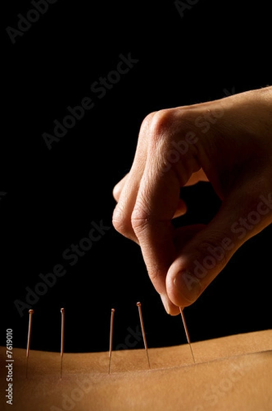 Obraz Acupuncture
