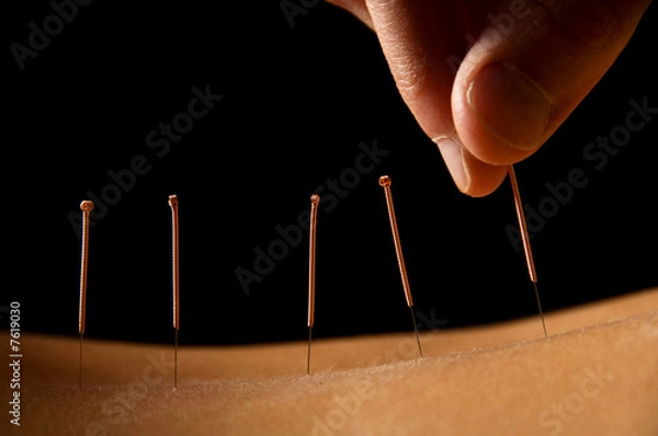 Obraz Acupuncture