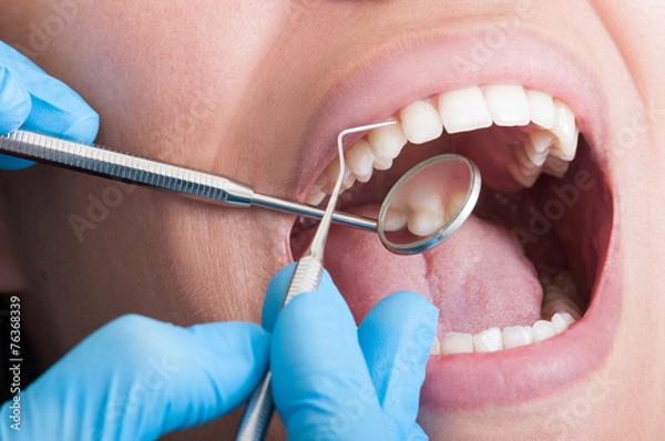 Fototapeta Dentysta czyści idealne zęby