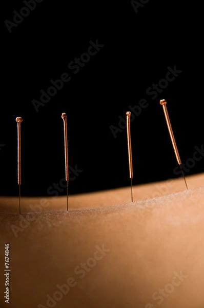 Obraz Acupuncture