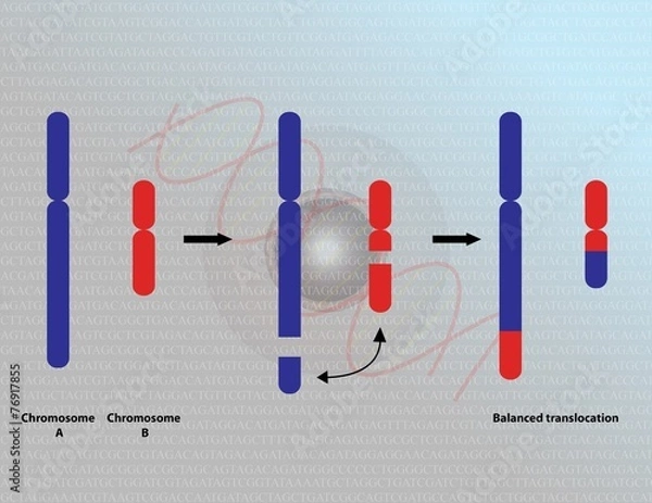 Obraz Chromosomal translocation