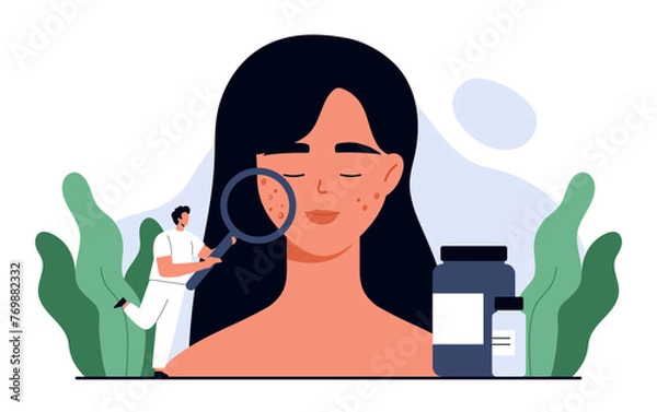 Fototapeta Acne concept. Dermatologist doctor holding magnifying glass and examining acne on woman face. Skin problem, dermatology treatment and skincare. Isolated vector illustration in cartoon style