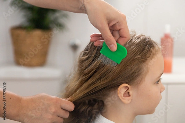 Fototapeta A woman helps to get rid of lice and parasites on the head of a little girl, combs her head with a special comb. Treatment of lice and nits