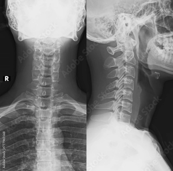Obraz normal human cervical xray