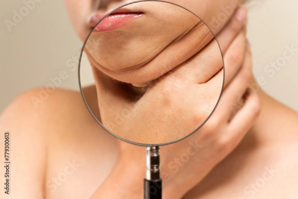 Obraz ルーペで女性の二重顎を拡大している.