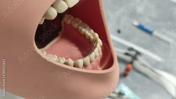 Obraz Dental mannequin for dental students with a dental splint placed on the teeth