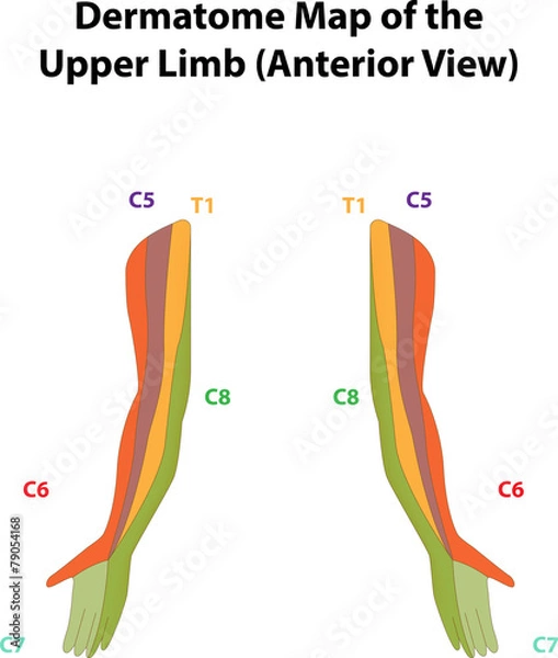 Obraz Dermatome Map of the Upper Limb