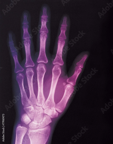 Obraz 포토시리즈