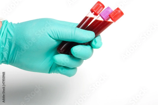 Fototapeta Blood Sample