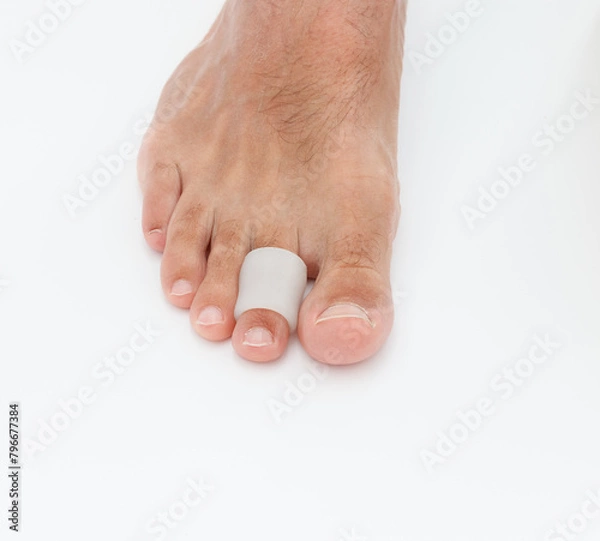 Fototapeta Feet silicone toe protector. Man wearing protector for claw or hammer toes
