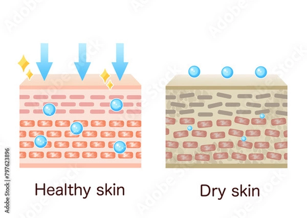 Obraz Comparison illustration of skin chart