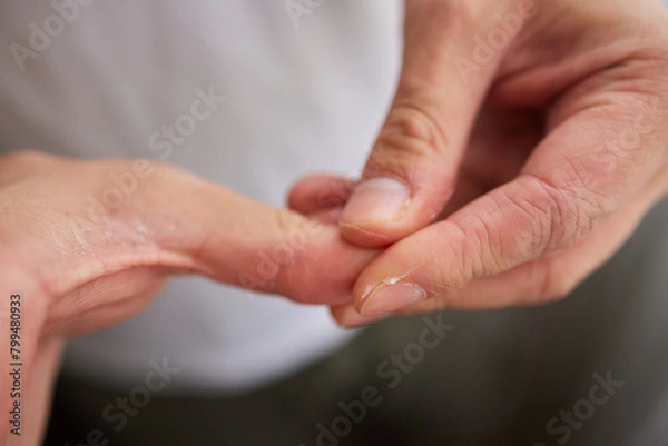 Fototapeta The man's hand, he uses steroids Apply External type.