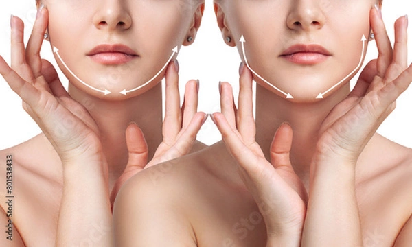 Fototapeta Woman before and after cheekbones shape correction.