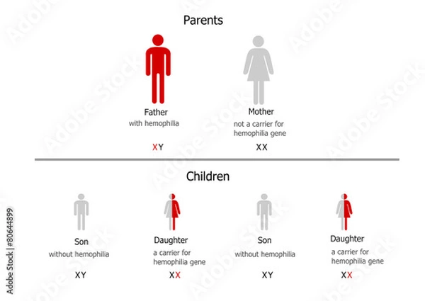 Obraz Hemophilia inheritance