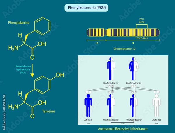 Obraz Phenylketonuria