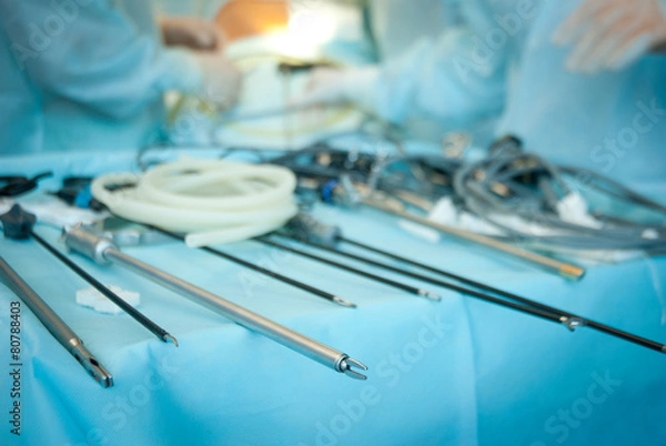 Obraz gallbladder removal