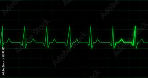 Fototapeta EKG Heartbeat reading animation on black background. Medical monitor displaying cardiography pulse checkup diagnosis electronic screen display machine. Cardiogram nubes rate ecg waveform surgery.