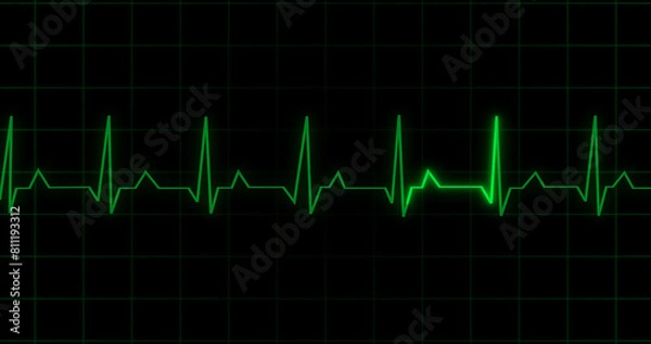 Fototapeta EKG Heartbeat reading animation on black background. Medical monitor displaying cardiography pulse checkup diagnosis electronic screen display machine. Cardiogram nubes rate ecg waveform surgery.