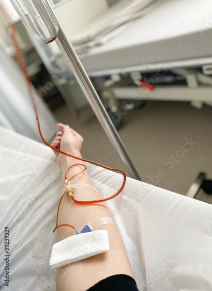 Fototapeta female hand with an IV in the clinic ward. Treatment of anemia in adults. Medical procedure in a hospital inpatient setting.