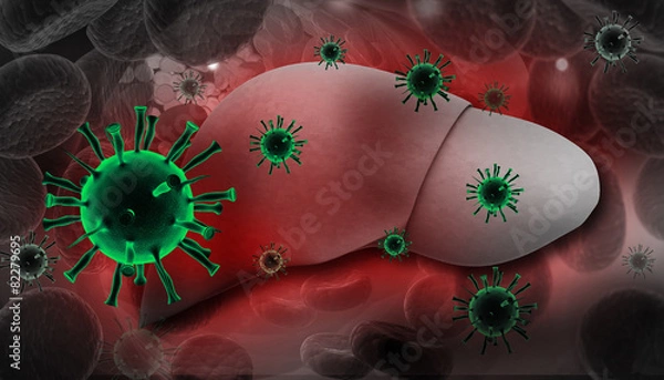 Obraz Liver Infection with hepatitis viruses.