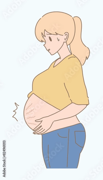 Obraz Pregnant woman with huge belly with stretch marks on last months of pregnancy, stomach ache. Hand drawn flat cartoon character vector illustration.