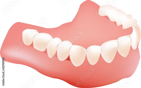 Fototapeta protesi dentale