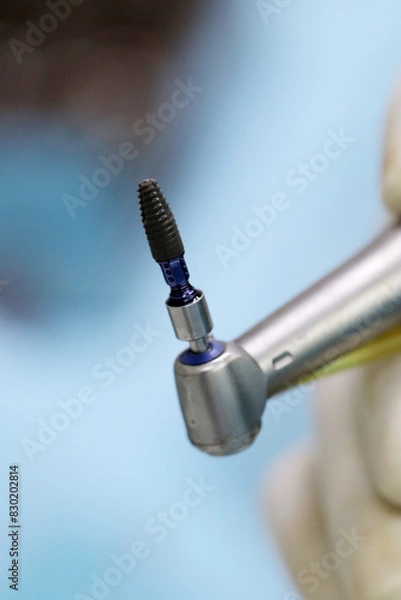 Obraz digital laboratory dentist prosthesis