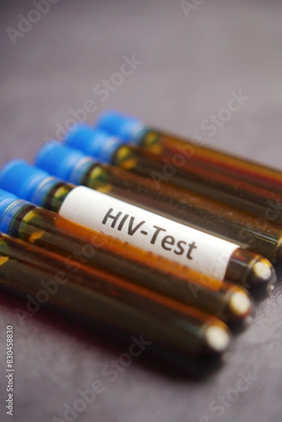 Fototapeta HIV blood test tube on black color background 