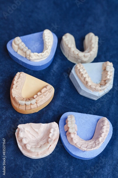 Fototapeta denture teeth