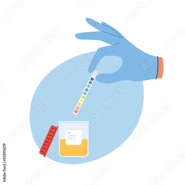 Fototapeta Urine analysis with a pH test. Hand in blue gloves holds an indicator strip for laboratory analysis. Pee sample in plastic container