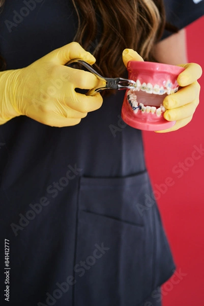 Fototapeta female dentist holds in her hands a dental model of the jaw with an incorrect bite and braces. dental supplies in the female hands of a doctor. dentist concept