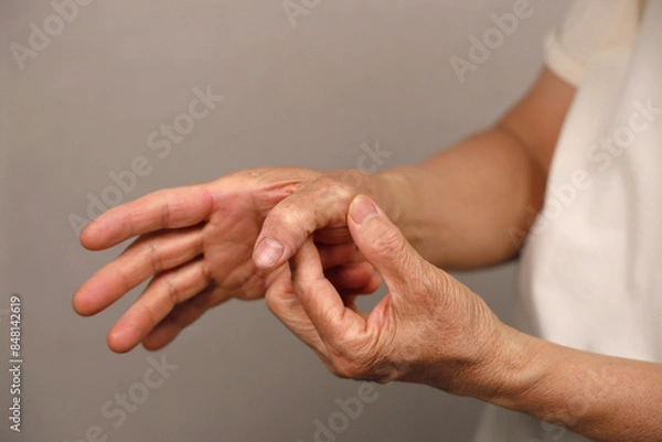 Fototapeta 류마티스관절염으로 엄지손가락 통증을 느끼는 여성 어르신의 손 클로즈업