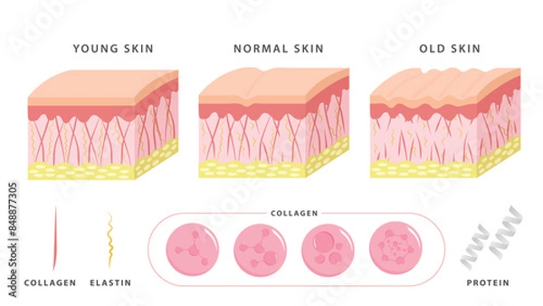 Obraz Aging process. comparison of young and aged skin. collagen, elastin and fibroblasts in younger and older skin. flat vector 2d illustration. Concept skin care cosmetics solution.