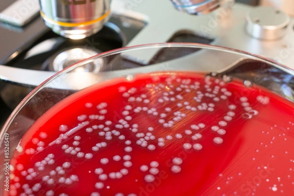 Obraz Bacteria colonies on petri dishes on microscope background