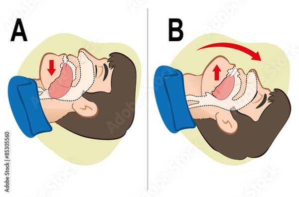 Obraz First Aid resuscitation (CPR), clearing breathing, positioning.
