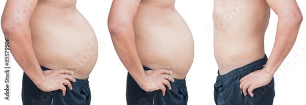 Fototapeta body man before and after fat  loss