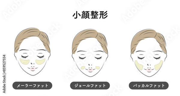 Fototapeta 小顔整形