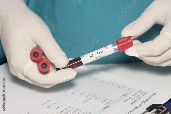 Obraz Test HIV