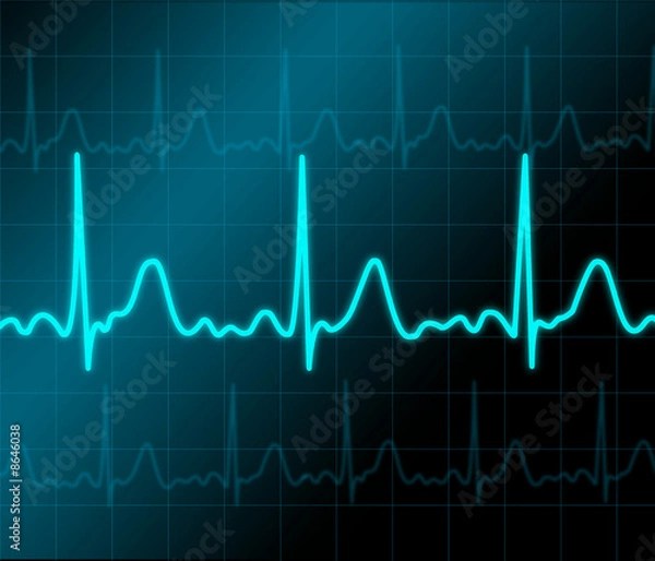 Fototapeta Heart monitor