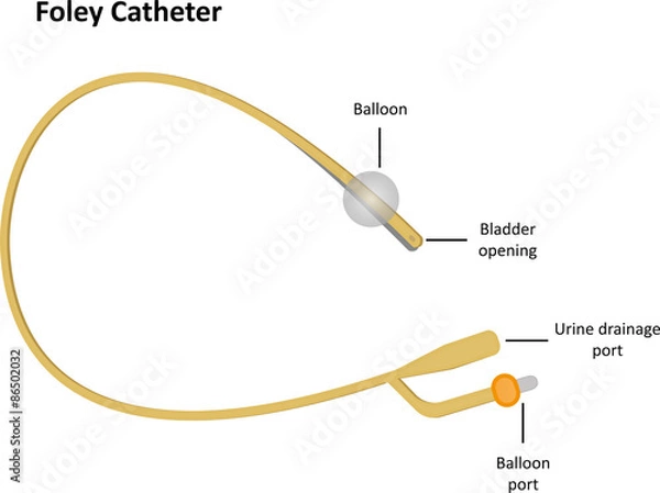 Fototapeta Foley Catheter Labeled