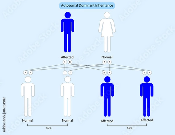 Obraz Autosomal dominant inheritance