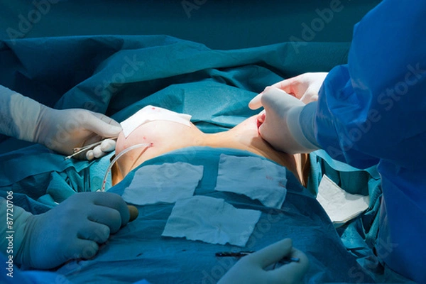 Fototapeta Breast augmentation