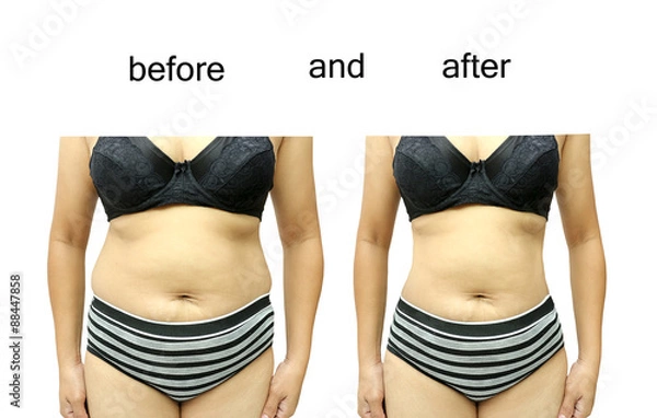 Obraz  after a diet