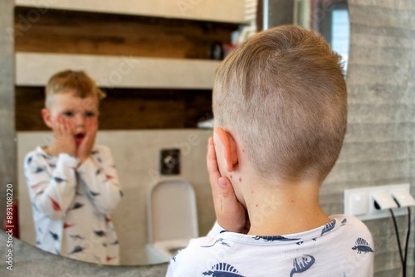 Fototapeta Natural vaccination. Contagious disease. Sick child with chickenpox. Varicella virus or Chickenpox bubble rash on child body and face. High quality photo