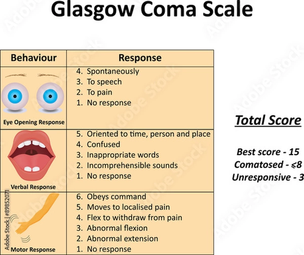 Obraz Glasgow Coma Scale Illustration