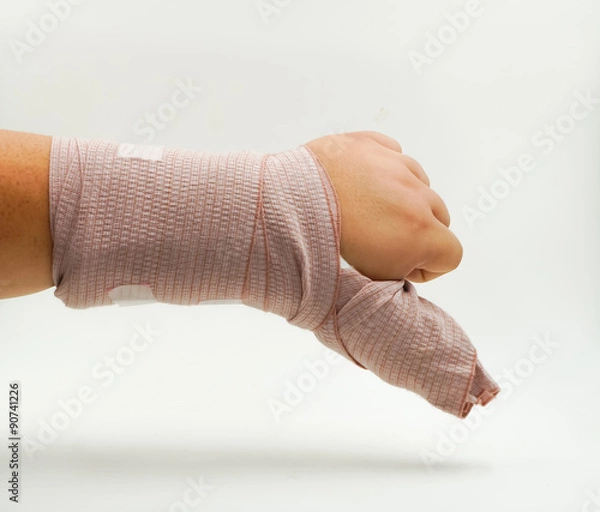 Obraz splint finger a broken bone