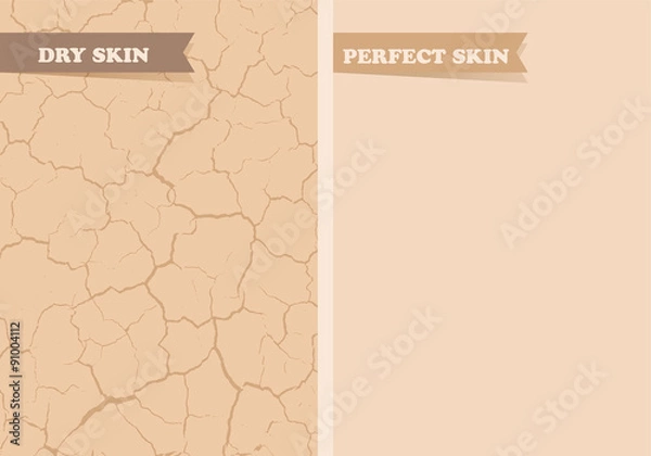 Obraz Sucha skóra, doskonała skóra