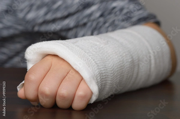 Fototapeta Unterarm in Gips