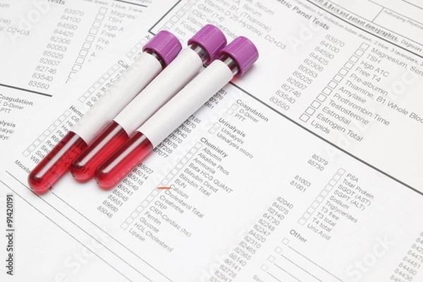 Fototapeta Form to fill in the results of biochemistry blood tests